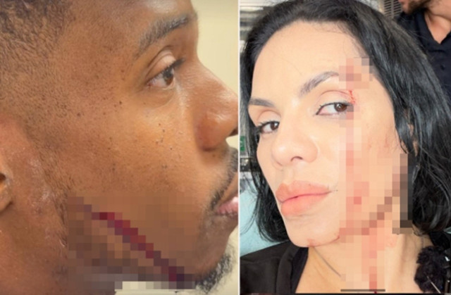 Fenomen gurmeler restoranda çekim yaparken ölüm tehlikesi atlattı! - Resim: 0