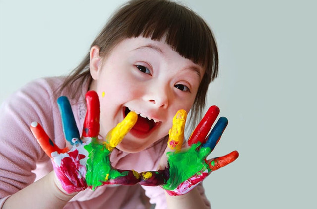 Down Sendromu nedir, belirtiler neler? Down Sendromu ilk kez ne zaman ortaya çıktı? - Resim: 0