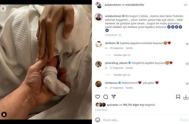 Arda Türkmen baba oldu ilk paylaşım geldi! İşte kızlarına verdikleri isim! - Resim: 4