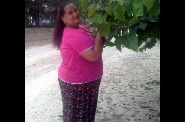 Midesini küçülten kadın hayatını kaybetti - Resim: 2