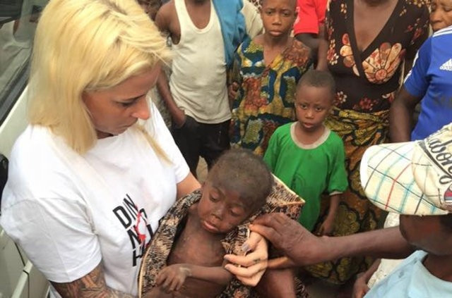 Ailesi cadı diye sokağa attı - Resim: 3