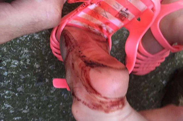 Sadece yarım saat giydi ayağı bu hale geldi! - Resim: 2