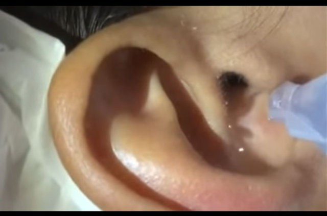 Kulak ağrısı şikayetiyle gitti içinden çıkana bakın - Resim: 1