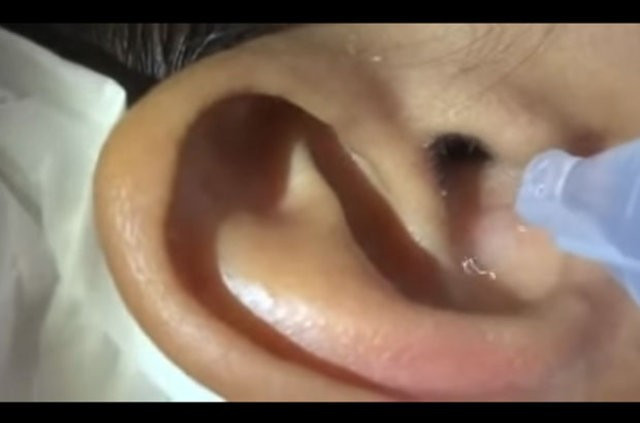 Kulak ağrısı şikayetiyle gitti içinden çıkana bakın - Resim: 2