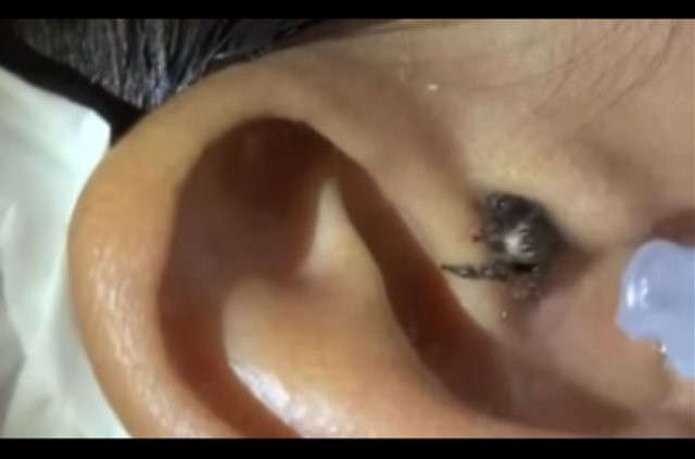 Kulak ağrısı şikayetiyle gitti içinden çıkana bakın - Resim: 3