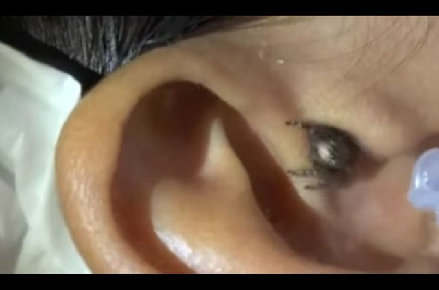 Kulak ağrısı şikayetiyle gitti içinden çıkana bakın - Resim: 4