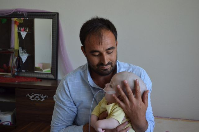 12 aylık bebeği görenler şoke oluyor! Beyni kafatasının dışında büyüyor - Resim: 2