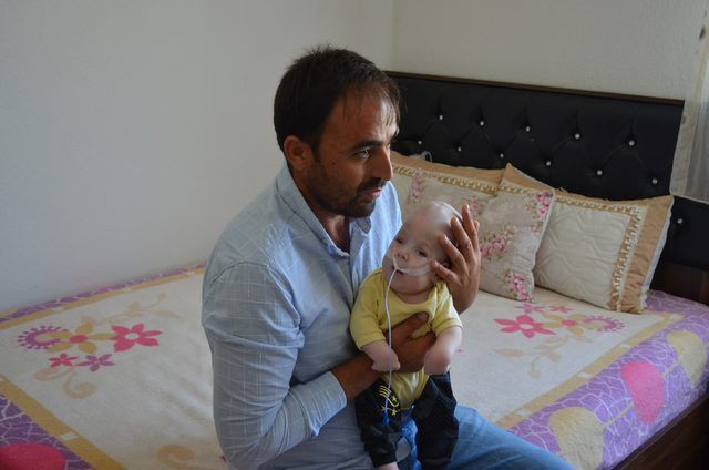 12 aylık bebeği görenler şoke oluyor! Beyni kafatasının dışında büyüyor - Resim: 3