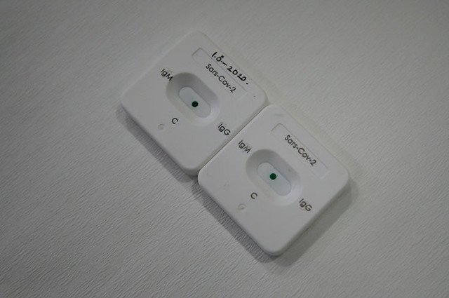 Koronavirüs 5 dakikada test edilecek - Resim: 0