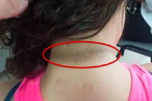 Annesi kir sandı ama hastalık çıktı! - Resim: 3