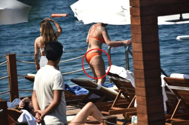 Takıntıları yüzünden ölümden dönen İrem Derici artık selülitlerini bile dert etmiyor! Selülit şov! - Resim: 3