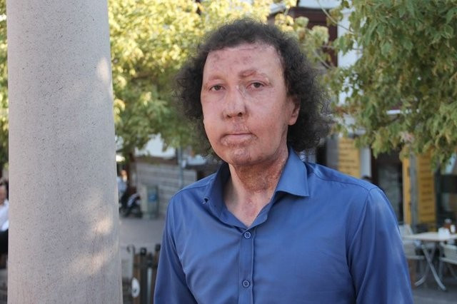 Yüzleri de hayatları da değişti - Resim: 3