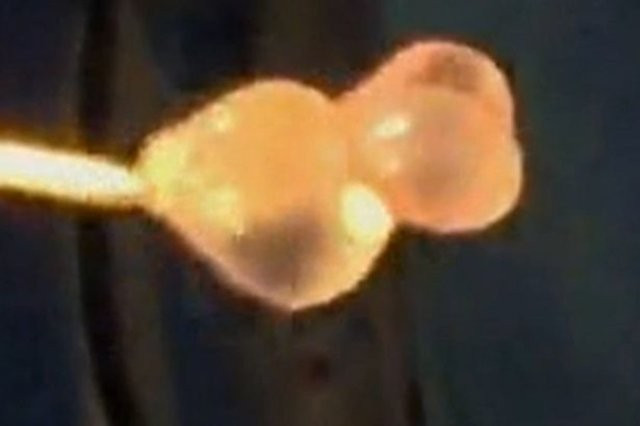 Beyninden çıkanlar herkesi dehşete düşürdü inanılmaz olay - Resim: 4