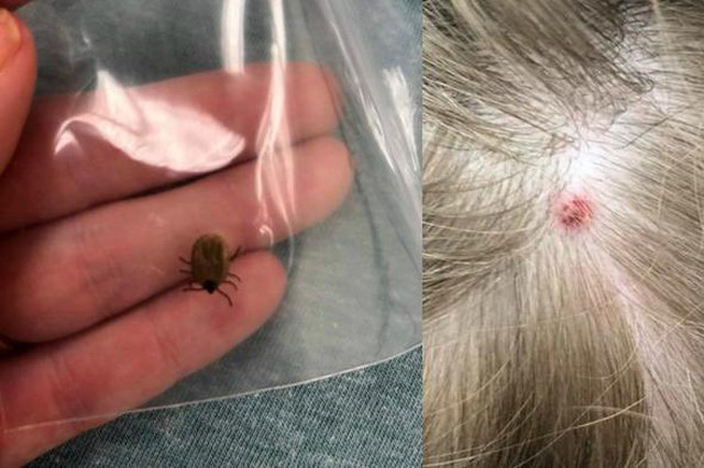 5 yaşındaki çocuk hareket edemiyordu! Doktorlar şok gerçeği fark etti - Resim: 2