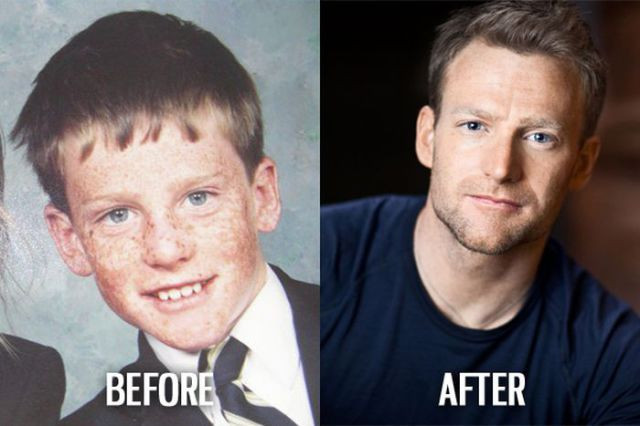 İnsan bu kadar mı değişir dedirten fotoğraflar - Resim: 2