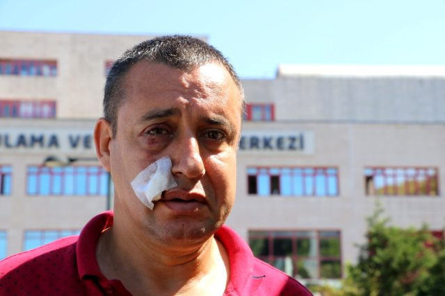 Yer Zonguldak! Belediye işçilerinden terörle mücadele gazisine asfalt dayağı - Resim: 0