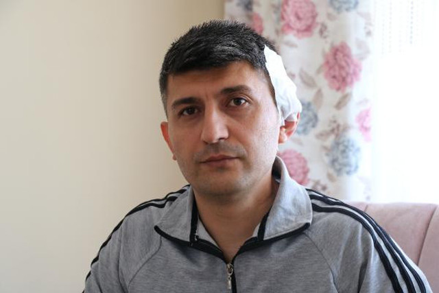 Kürekli saldırıya uğrayan komiser konuştu!  İyi ki elimi silahıma götürmedim - Resim: 0