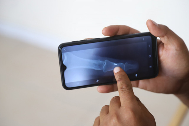 Van'da 16 yıl parmağına giren iğneyle yaşadı - Resim: 0