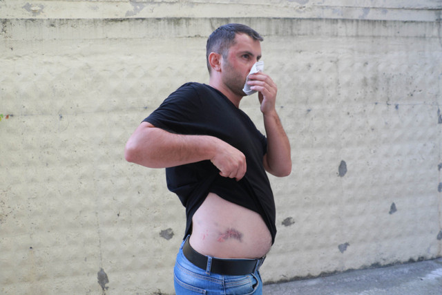 Samsun'da 7 dakika boyunca darp edilen adam: Stres topu olmaktan yorulduk - Resim: 0