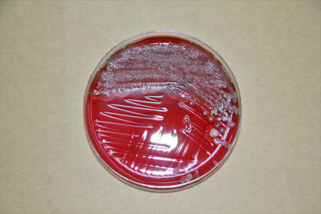 Tehlike saçıyor! Uzun süre kullanılan maskedeki bakteriler laboratuvarda gözler önüne serildi - Resim: 0