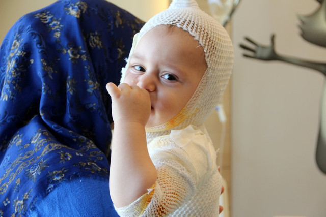 Kaynar süt faciası! Yusuf bebeğin tüm vücudu yandı - Resim: 1