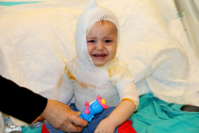 Kaynar süt faciası! Yusuf bebeğin tüm vücudu yandı - Resim: 0