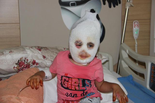 Ağrı'da kardeşiyle banyoda oyun oynamak istemişti! 4 yaşındaki Ayfer feci şekilde yandı - Resim: 1