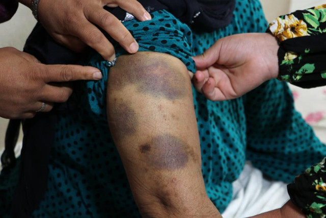 Adana'da yaşlı kadına yoğun bakımda darp iddiası! - Resim: 0