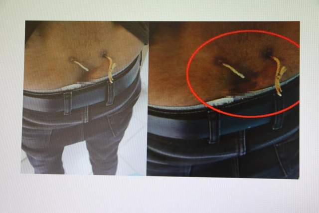 Elazığ'da belinden çamaşır ipi geçirmişler nedeni pes dedirtti - Resim: 1