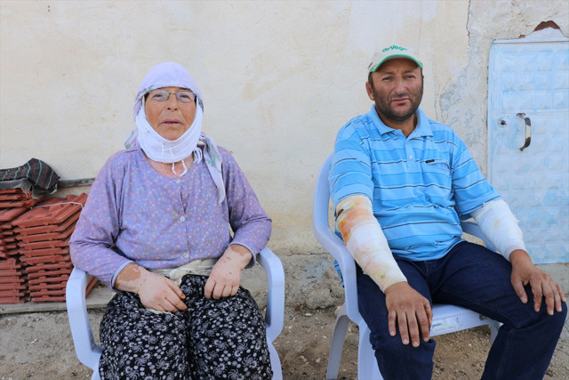 Denizli'de alevlerin arasında kalan vatandaş: Kollarımın eridiğini gördüm - Resim: 1