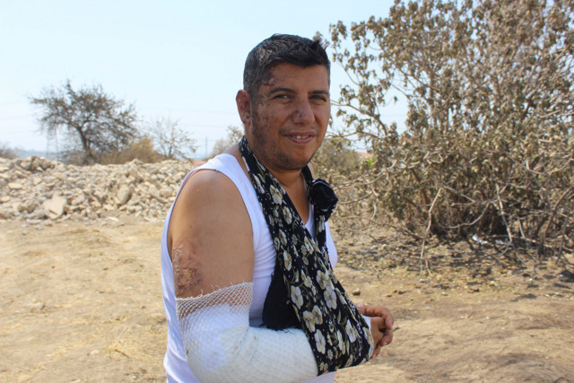 Manavgat'ta yanmayı göze alıp anne ve babasını alevler arasından kurtardı - Resim: 2