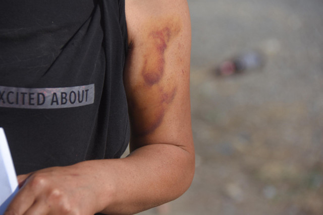 İzmir'de darp iddiasında karşı taraf konuştu: Olay kedi-köpek kavgasından ibaret değil - Resim: 1