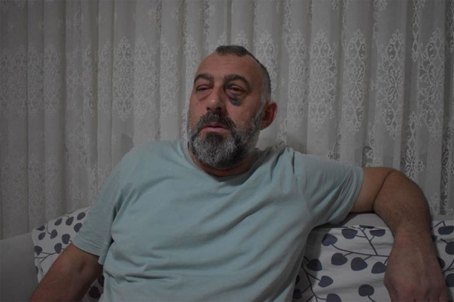 Kocaeli Gebze'de yolcunun 'şerefsiz’ dediği şoför bakın kim çıktı feci şekilde dayak yedi - Resim: 0