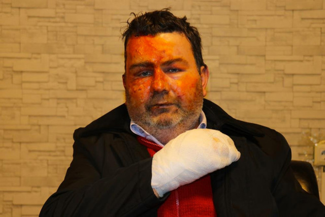 Sakarya'da dehşeti yaşadı! Can havliyle uykusundan uyandı yüzü tanınmaz hale geldi - Resim: 2