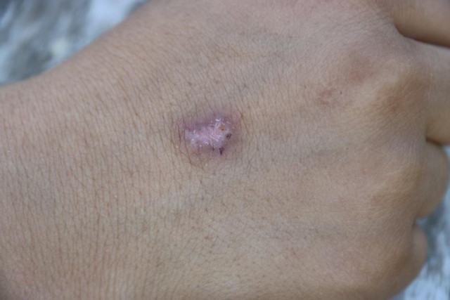 Küçük çocuğun üzerinde sigara söndürüldü iddiası! Eski karı-koca birbirini suçladı - Resim: 1