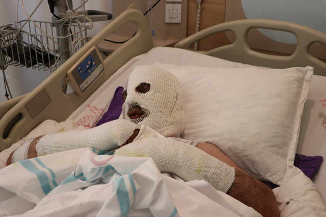 Ağrı'da evde bir anda alevler içinde kaldı! Vatandaşları uyardı: Kimse yapmasın - Resim: 0