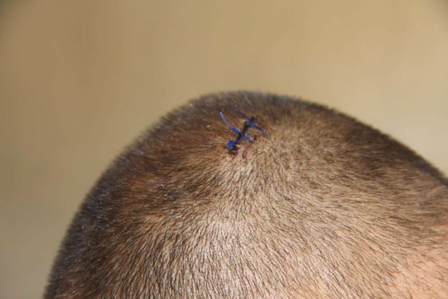 Tıraş makinesi yere düştü huzur kalmadı doğduğum yeri terk etmek zorunda kalacağım - Resim: 1