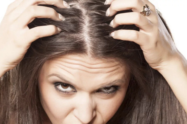 Saçınızı fışkırtacak sizi en az 10 yaş gençleştirecek formül hazır deneyen yaşadı! - Resim: 2