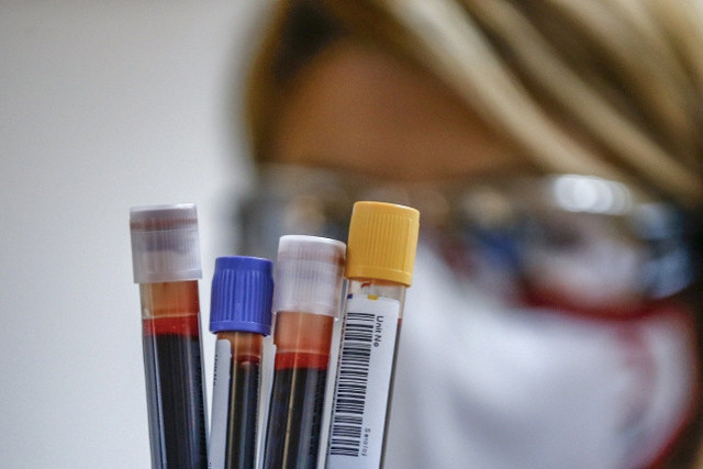 Kan grubu A RH olanlar bunları yerken aman dikkat! Hasta edebilir - Resim: 0