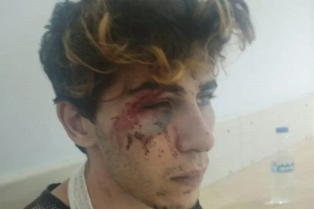 Sevgilisinden çıplak fotoğraf isteyip kendisine silahla işkence ettiler! Sosyal medyada yayınladılar - Resim: 0