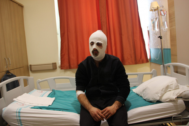 Yemek ısıtmak isteyen tır şoförü, piknik tüpünün alev almasıyla faciayı yaşadı - Resim: 0