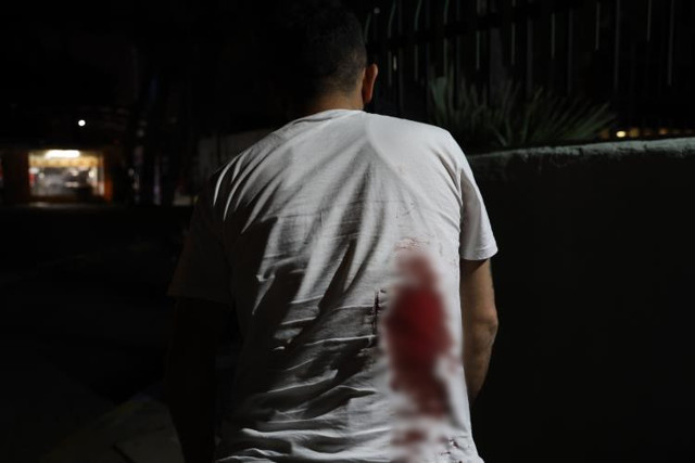 Taksiciden “Aracımı kapattım” cevabını alan yolcu, şoförün sırtına makas sapladı - Resim: 1