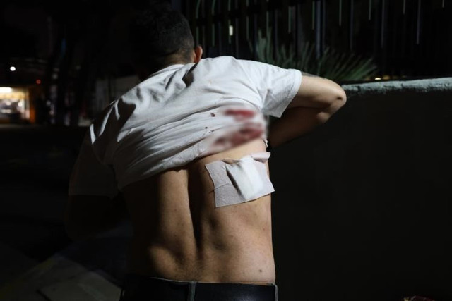 Taksiciden “Aracımı kapattım” cevabını alan yolcu, şoförün sırtına makas sapladı - Resim: 2