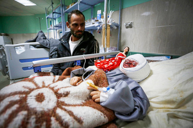 Yanıkların acısıyla kıvranan küçük çocuğun çığlıkları yürek burktu - Resim: 1