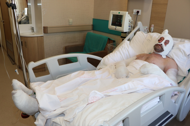Sobanın yanında unuttuğu benzin bidonu canından ediyordu - Resim: 1