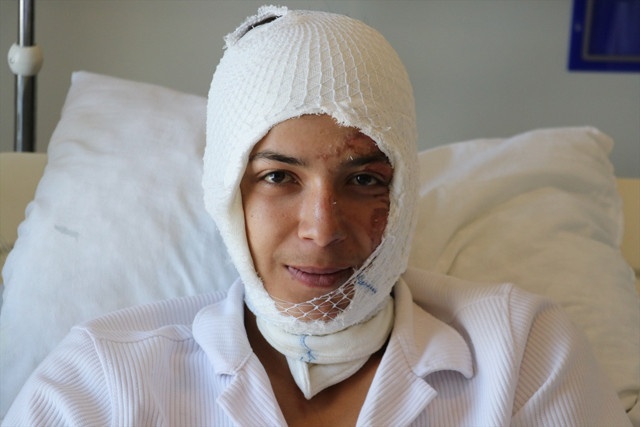 Elinde patlayan elektronik sigara, yüzünü ve vücudunu yaktı - Resim: 1