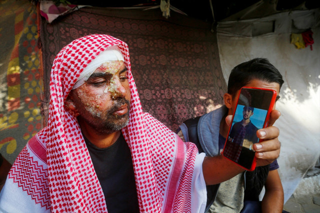 İsrail'in Gazze'deki çadır kampa düzenlediği saldırıda Filistinliler diri diri yandı - Resim: 1