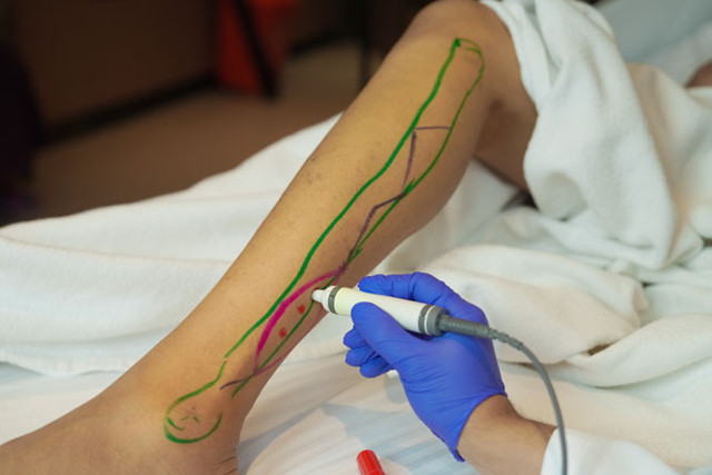 Doku transferiyle yara onarımında yeni dönem! Bu yöntem yaranıza merhem oluyor - Resim: 1