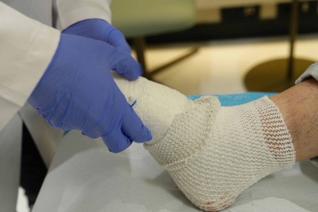 65 yaşındaki diyabet hastasının ayağı kesilmekten kurtuldu - Resim: 1