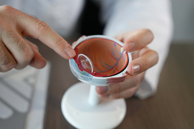 Gözlüksüz yaşam mümkün! Akıllı mercek ameliyatı ile gözlüklerinize elveda deyin - Resim: 0